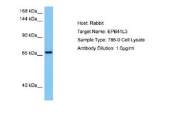 EPB41L3 Rabbit anti-Human, Polyclonal, Novus Biologicals 0.1 mL | Buy Online | Novus Biologicals | Fisher Scientific